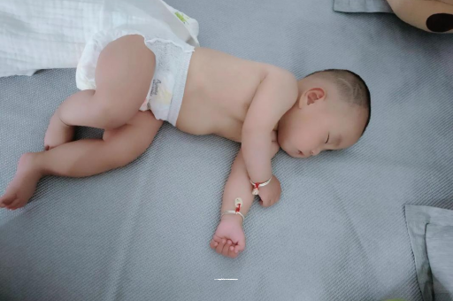 章丘宝宝头上长痱子